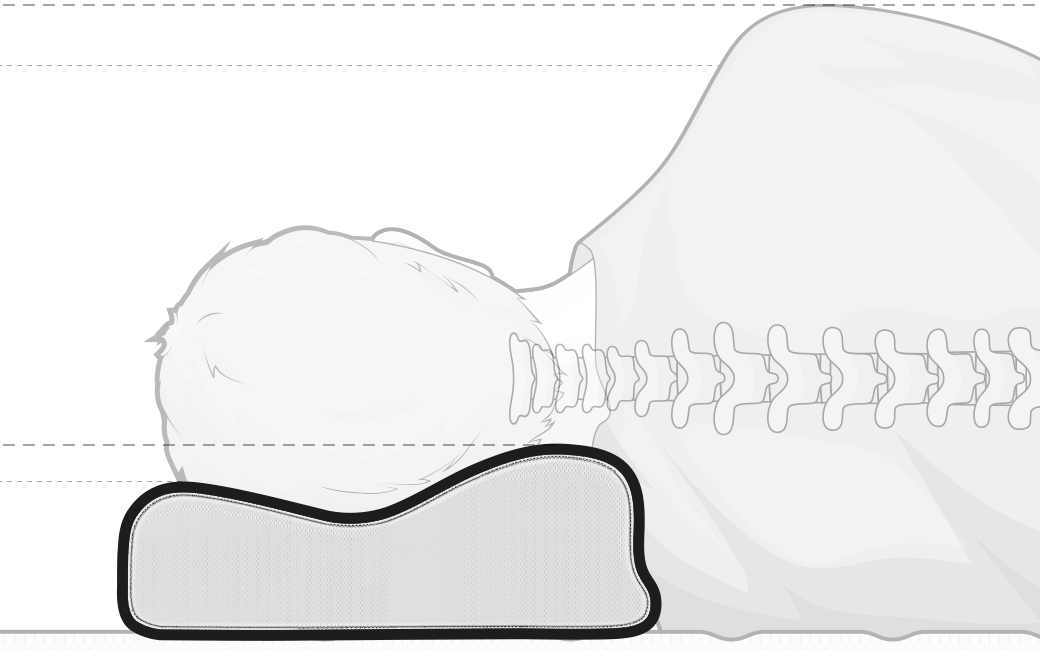 Oreiller ergonomique BODYGUARD sur lequel repose sur la partie haute, une personne dormant sur le côté. Onvoit par transparence les cervicales et la colonne vertébrale droite. 