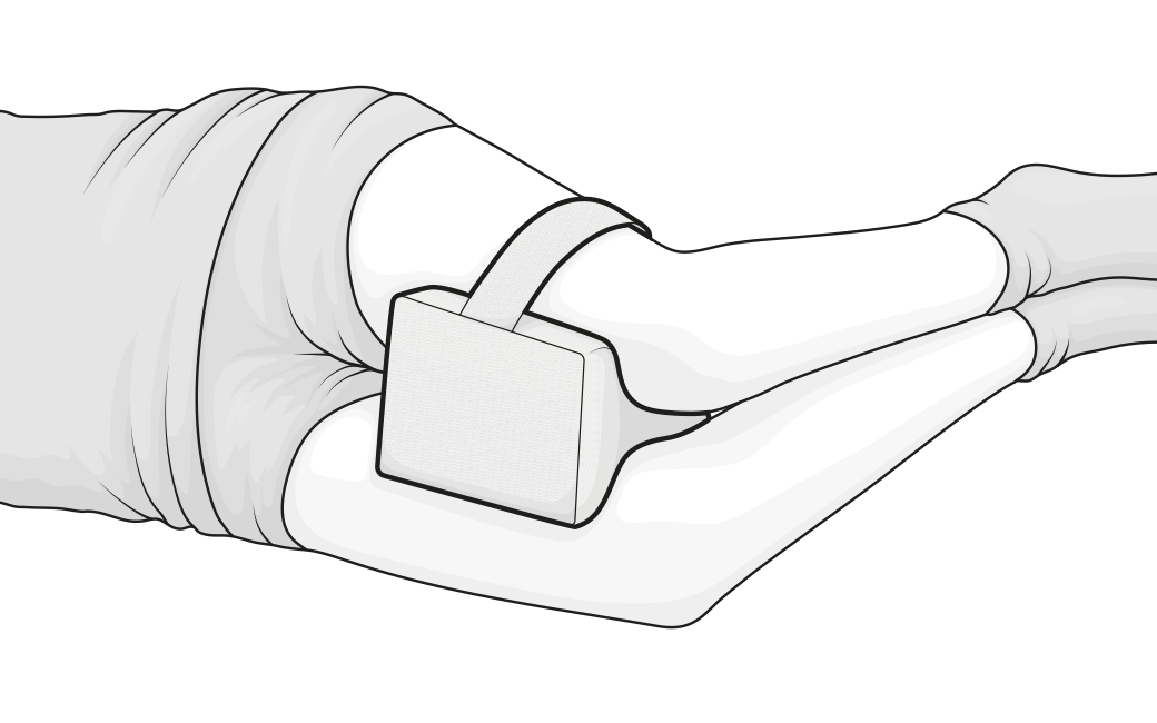 Illustration d’une personne allongée sur le côté avec le coussin de genoux fixé entre les genoux à l’aide de la sangle. Le coussin épouse l’écartement naturel des jambes pour soulager les hanches et le dos.