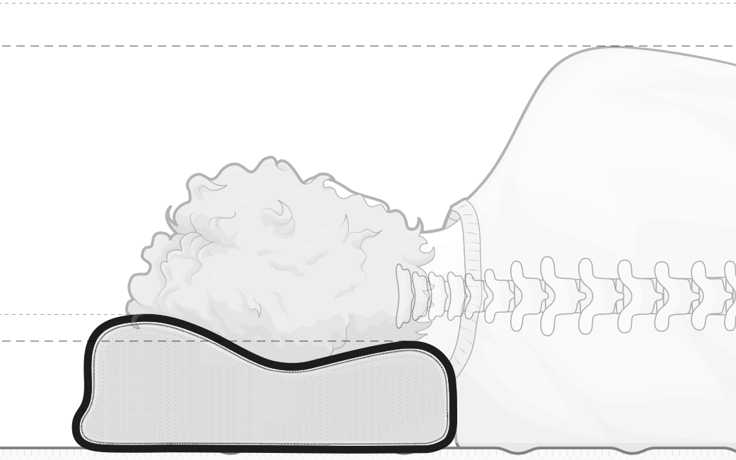 Oreiller ergonomique BODYGUARD sur lequel repose sur la partie basse, une personne dormant sur le côté. Onvoit par transparence les cervicales et la colonne vertébrale droite. 