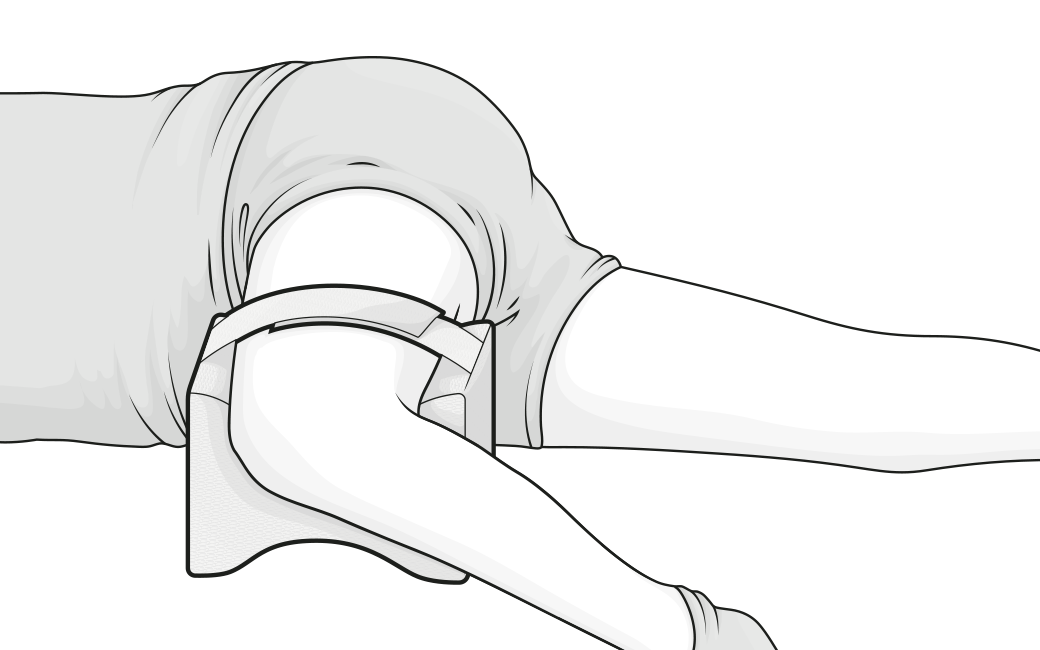 Illustration d’une personne allongée sur le côté avec le coussin de genoux BODYGUARD® placé et fixé entre les cuisses. Cette position vise à maintenir l’alignement du bassin pendant le sommeil.